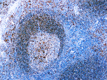 CD79A B-CELL