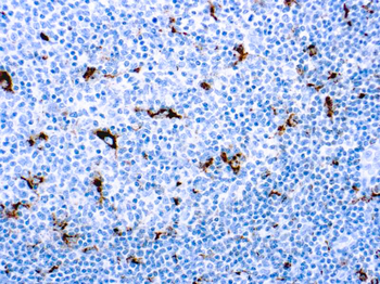 CD68 MACROPHAGE