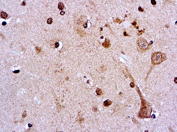 AMYLOID PRECURSOR PROTEIN (APP)