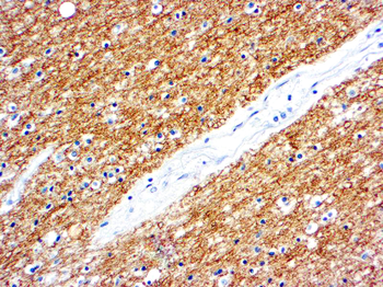 MYELIN BASIC PROTEIN
