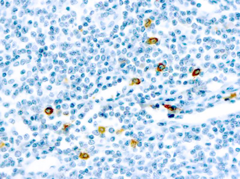 MAST CELL CHYMASE