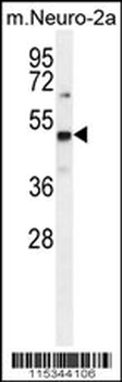 PRMT1 Antibody (C-term K342)