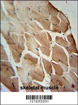 ACOT11 Antibody (C-term)