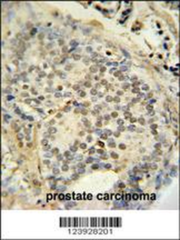 FUS Antibody (C-term)
