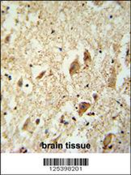 KATL1 Antibody (N-term)