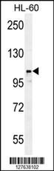 LNPEP Antibody (N-Term)