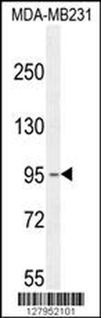 KCNT2 Antibody (C-term)