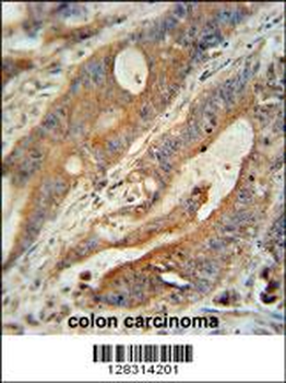 ZBBX Antibody (N-term)