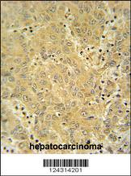 CYP2A7 Antibody (Center)