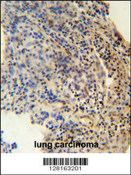 ZNF197 Antibody (N-term)