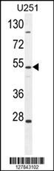 ZIK1 Antibody (Center)