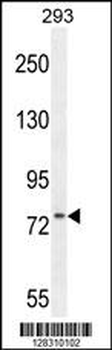 ZNF611 Antibody (N-term)