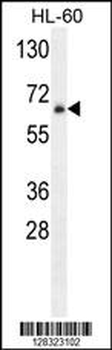 ZNF30 Antibody (N-term)