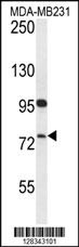 HFM1 Antibody (C-term)