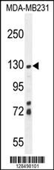 ZSWIM6 Antibody (C-term)