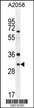 ARV1 Antibody (N-term)
