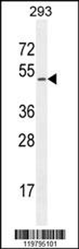 CHRDL1 Antibody (N-term)