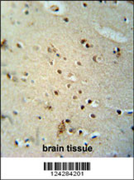 CIC Antibody (N-term)