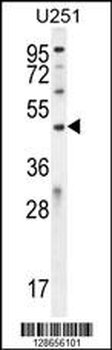ICEF1 Antibody (C-term)