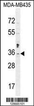 MTX2 Antibody (C-term)