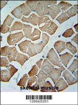 MTX2 Antibody (C-term)