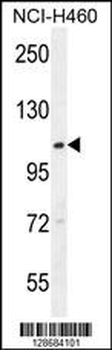 ACD10 Antibody (Center)