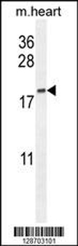 ODF3B Antibody (N-term)
