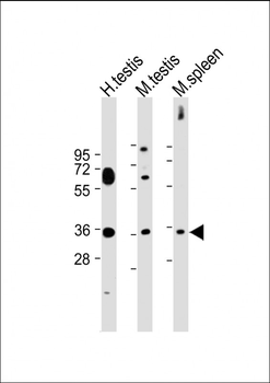 ASB17 Antibody (C-term)