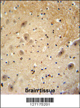 WDSOF1 Antibody (C-term)