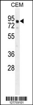 GLB1L2 Antibody (C-term)