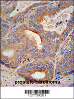 GLB1L2 Antibody (C-term)