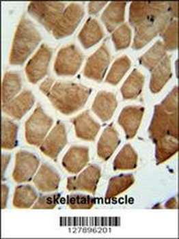 WDR49 Antibody (C-term)