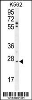 TNFAIP8 Antibody (N-term)