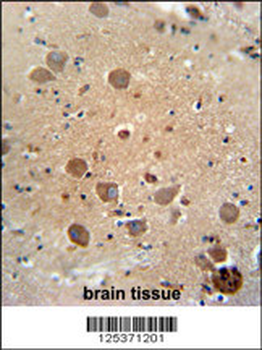 CF062 Antibody (Center)