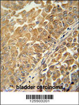 CR025 Antibody (Center)