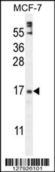 ZNF720 Antibody (Center)