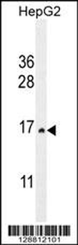 CST9 Antibody (C-term)
