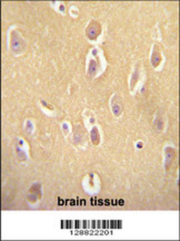 OR13J1 Antibody (C-term)