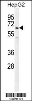 UBFD1 Antibody (N-term)