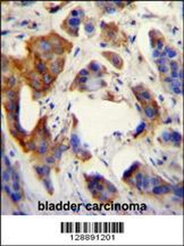 UBFD1 Antibody (N-term)