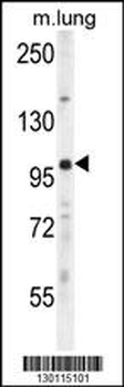 UNK Antibody (N-term)