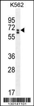 CLIP3 Antibody (C-term)