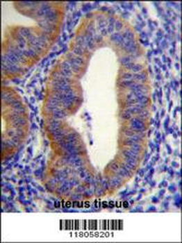 FGD6 Antibody (C-term)