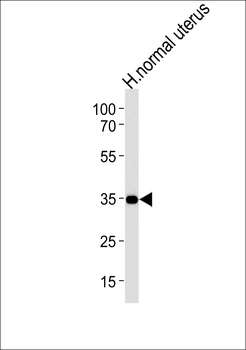CUZD1 Antibody (C-term)