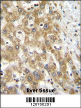 NPS3A Antibody (Center)