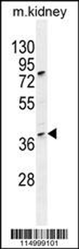 CCNH Antibody (N-term)