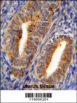 DPP3 Antibody (C-term)