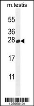 PLD6 Antibody (Center)
