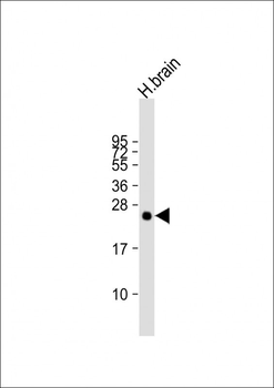 PLD6 Antibody (Center)