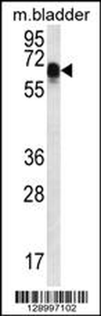 CCDC102A Antibody (C-term)